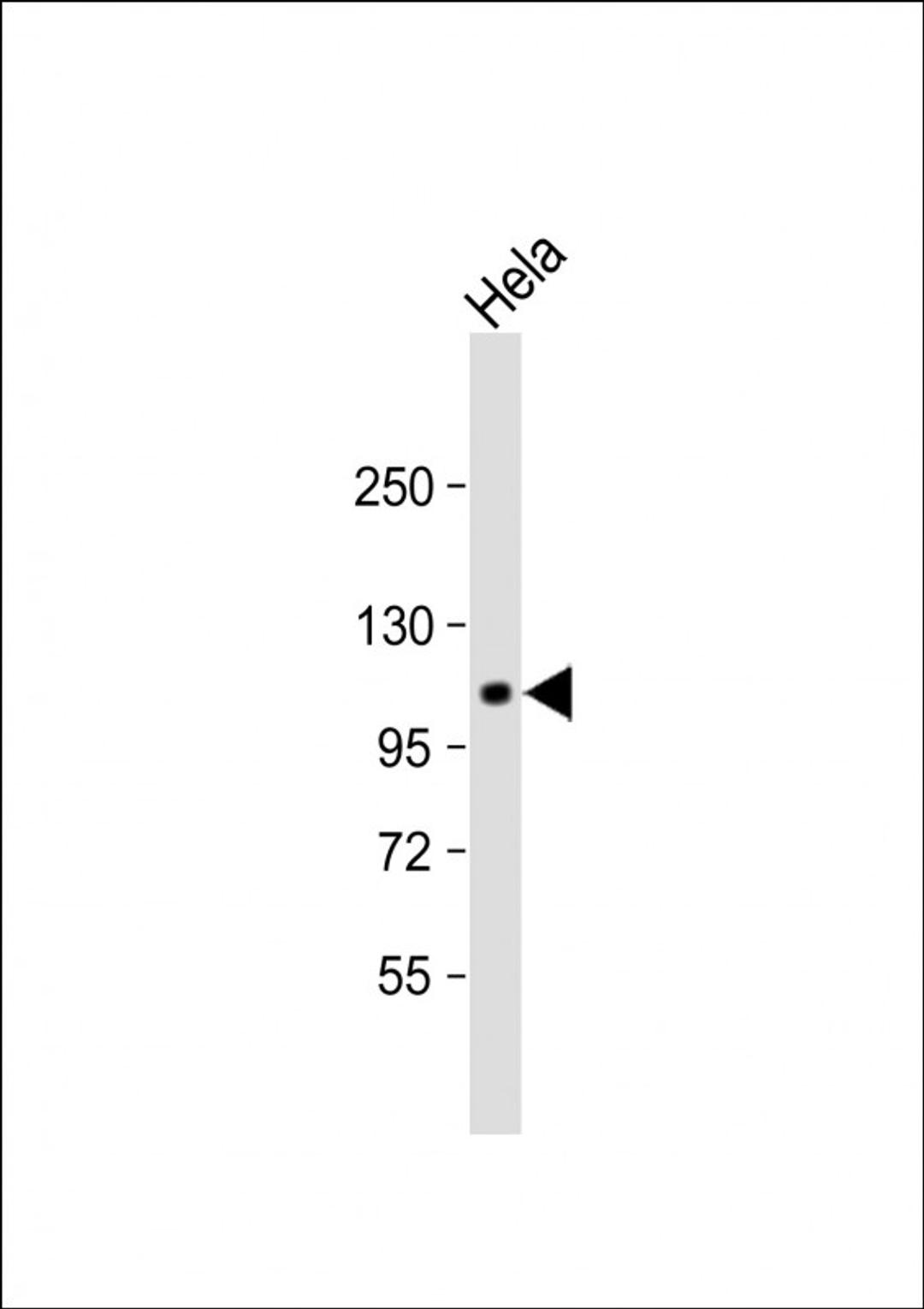 Western Blot at 1:1000 dilution + Hela whole cell lysate Lysates/proteins at 20 ug per lane.