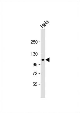 Western Blot at 1:1000 dilution + Hela whole cell lysate Lysates/proteins at 20 ug per lane.