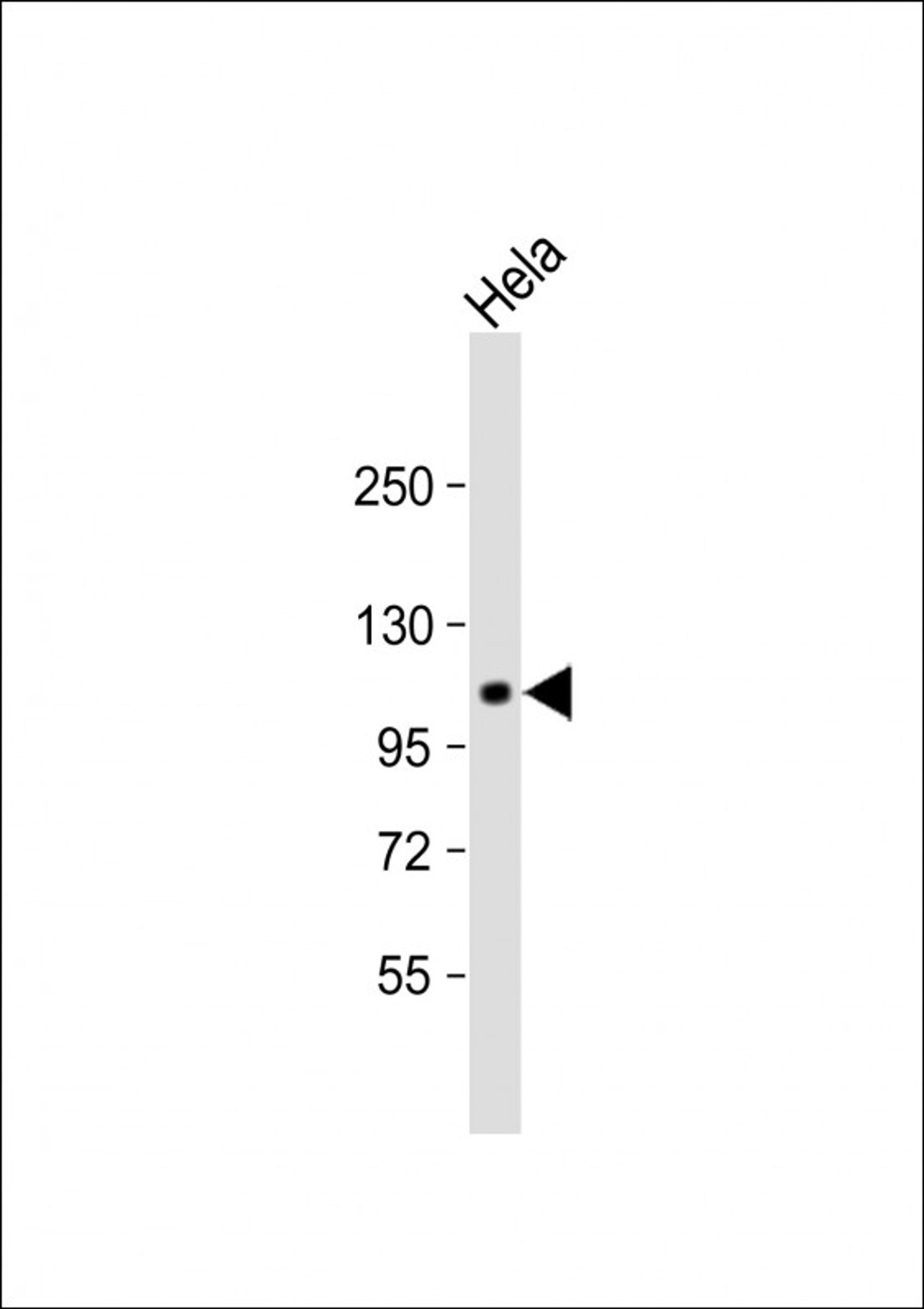 Western Blot at 1:1000 dilution + Hela whole cell lysate Lysates/proteins at 20 ug per lane.