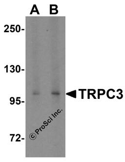 Western blot analysis of TRPC3 in human heart tissue lysate with TRPC3 antibody at (A) 1 and (B) 2 μg/mL.