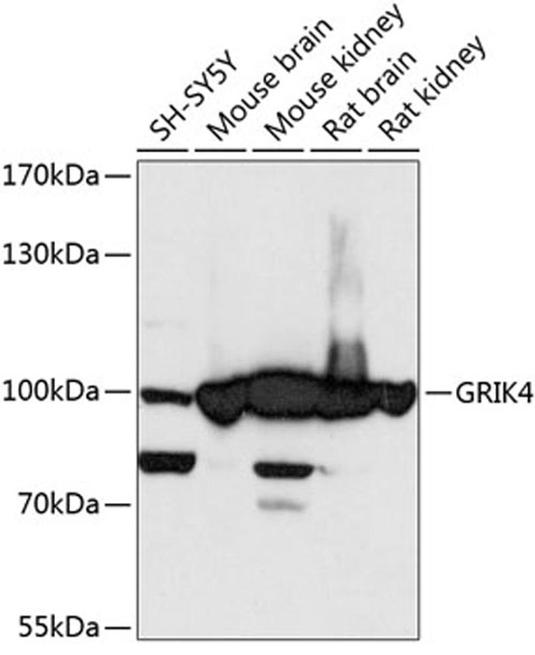 Western blot - GRIK4 antibody (A13800)