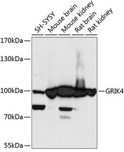 Western blot - GRIK4 antibody (A13800)