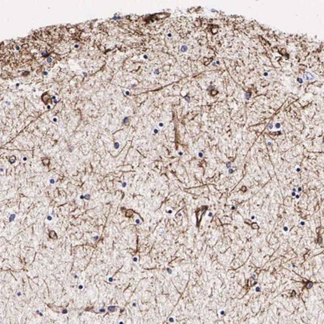 Immunohistochemistry-Paraffin: L3MBTL2 Antibody [NBP1-85164] - Staining of human hippocampus shows positivity in glial cells.