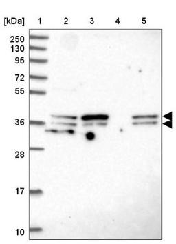 Western Blot: SUGT1 Antibody [NBP2-38518] - Lane 1: Marker [kDa] 250, 130, 95, 72, 55, 36, 28, 17, 10<br/>Lane 2: RT-4<br/>Lane 3: U-251 MG<br/>Lane 4: Human Plasma<br/>Lane 5: Liver