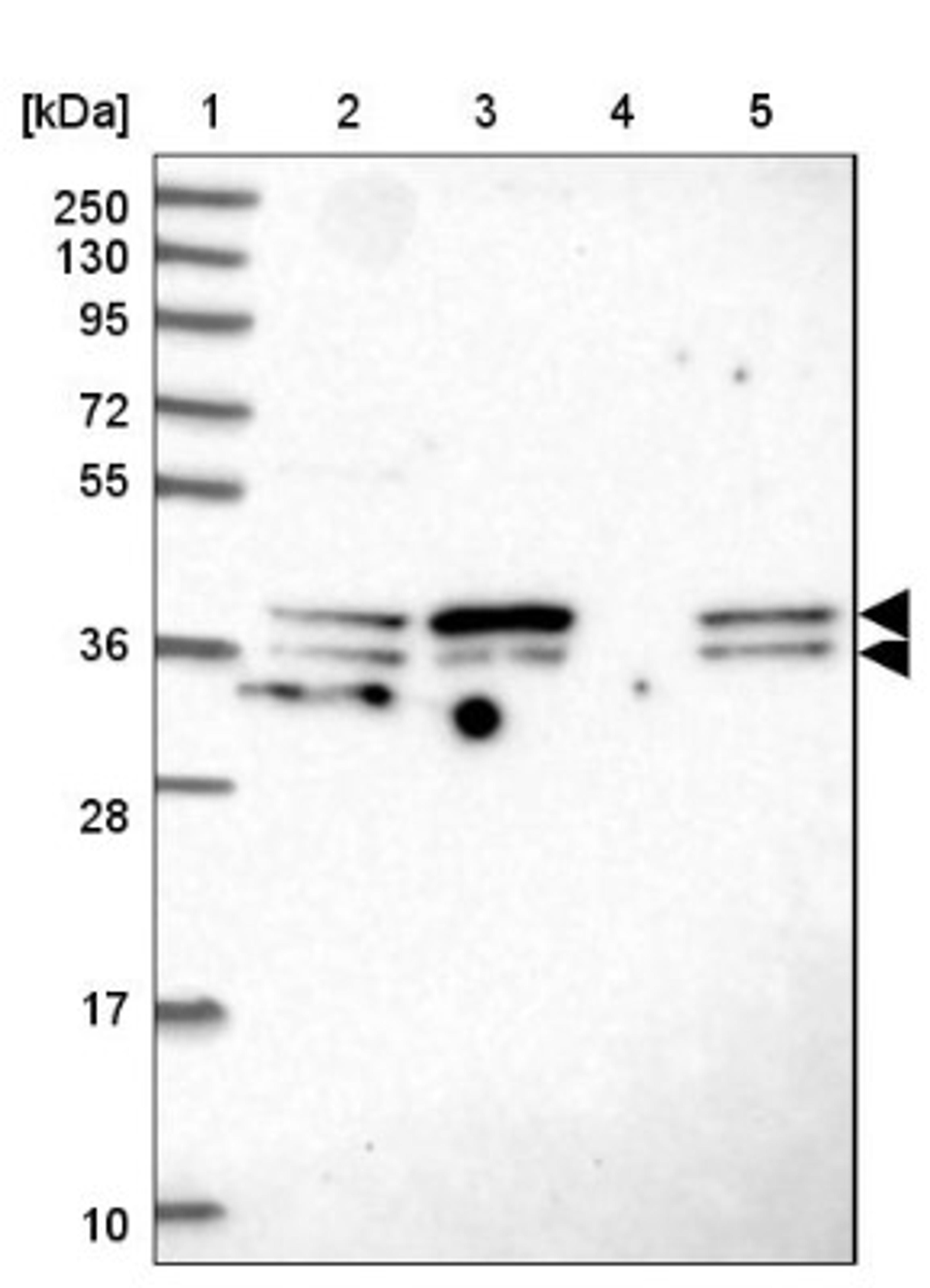 Western Blot: SUGT1 Antibody [NBP2-38518] - Lane 1: Marker [kDa] 250, 130, 95, 72, 55, 36, 28, 17, 10<br/>Lane 2: RT-4<br/>Lane 3: U-251 MG<br/>Lane 4: Human Plasma<br/>Lane 5: Liver