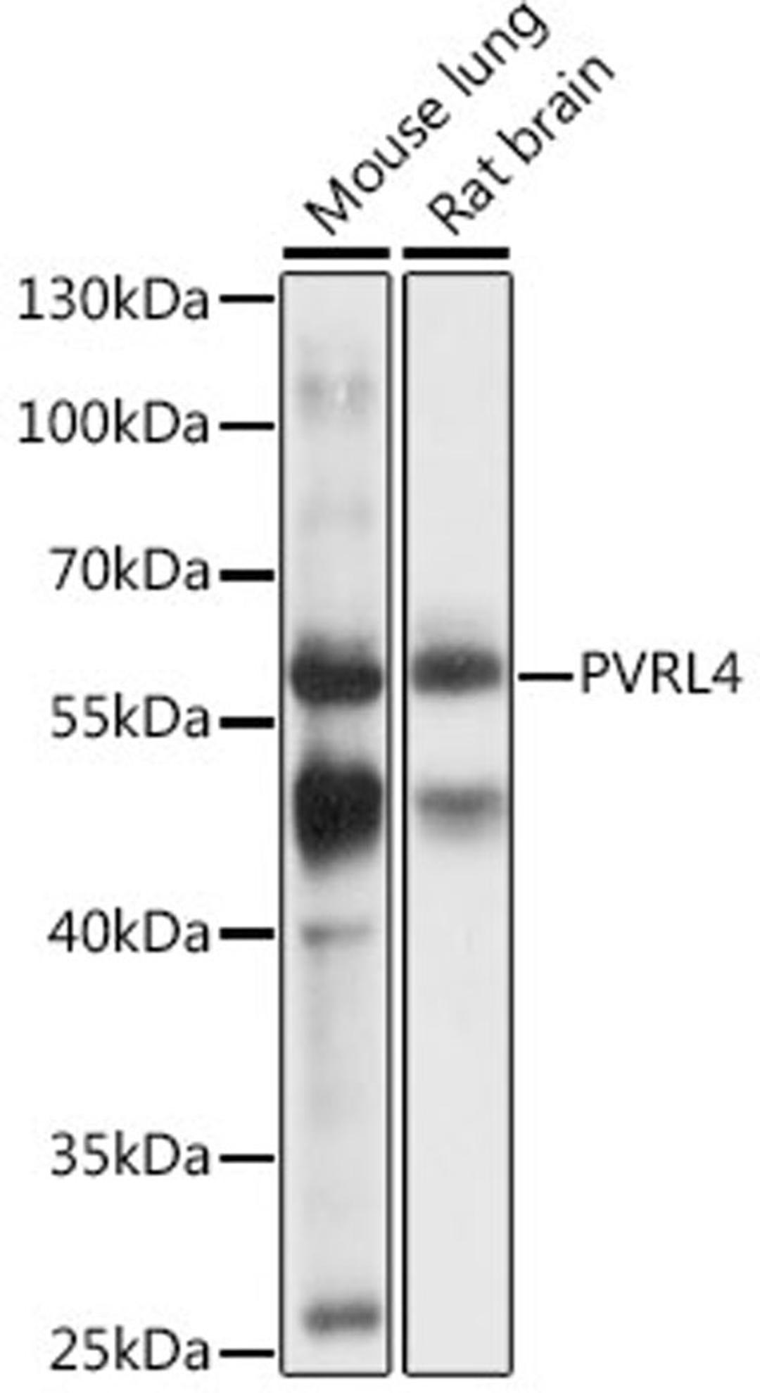 Western blot - PVRL4 antibody (A16149)