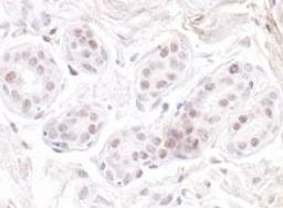 Detection of human GNL3 by immunohistochemistry.