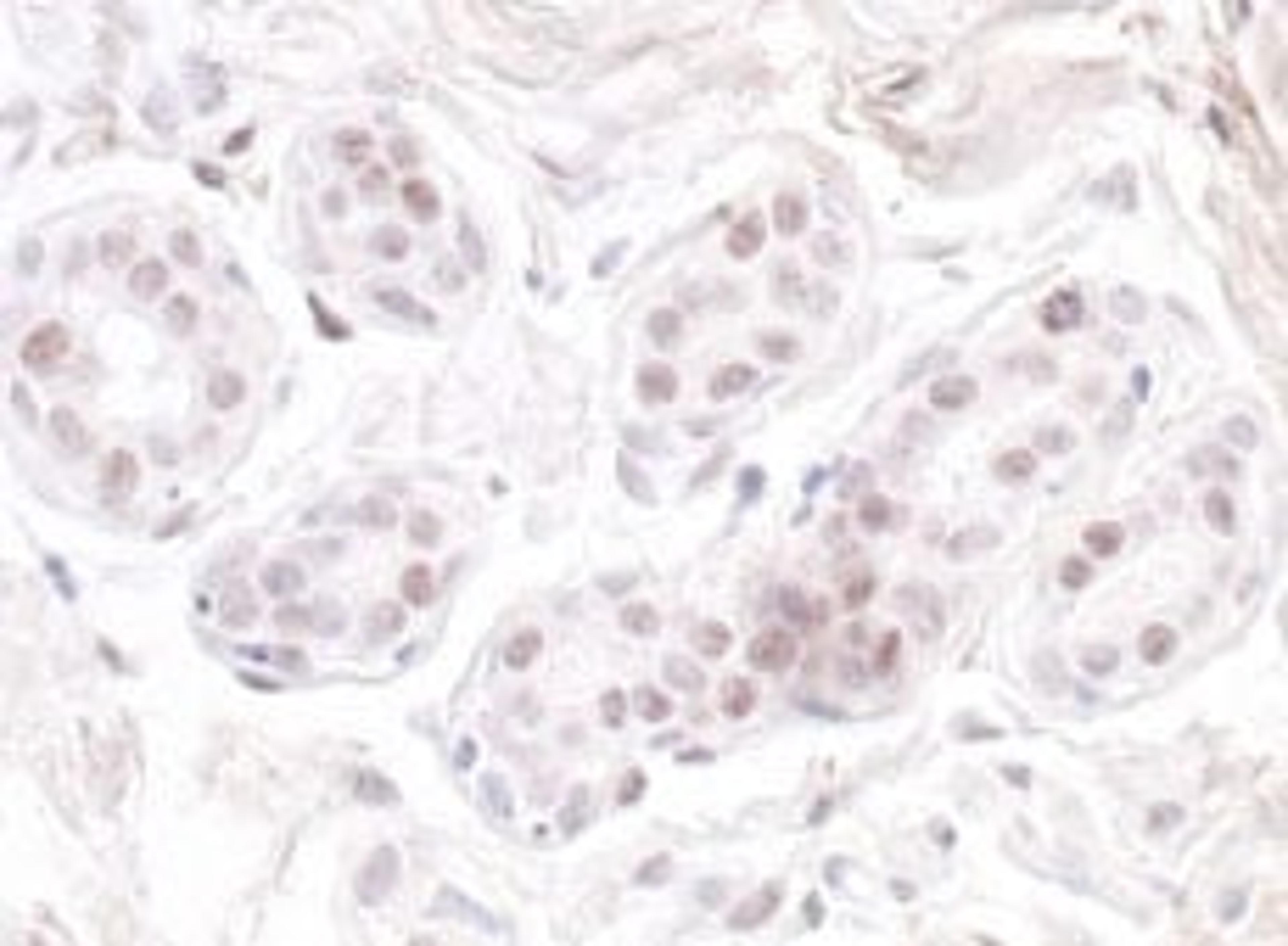 Detection of human GNL3 by immunohistochemistry.