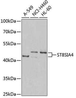 Western blot - ST8SIA4 Antibody (A6754)