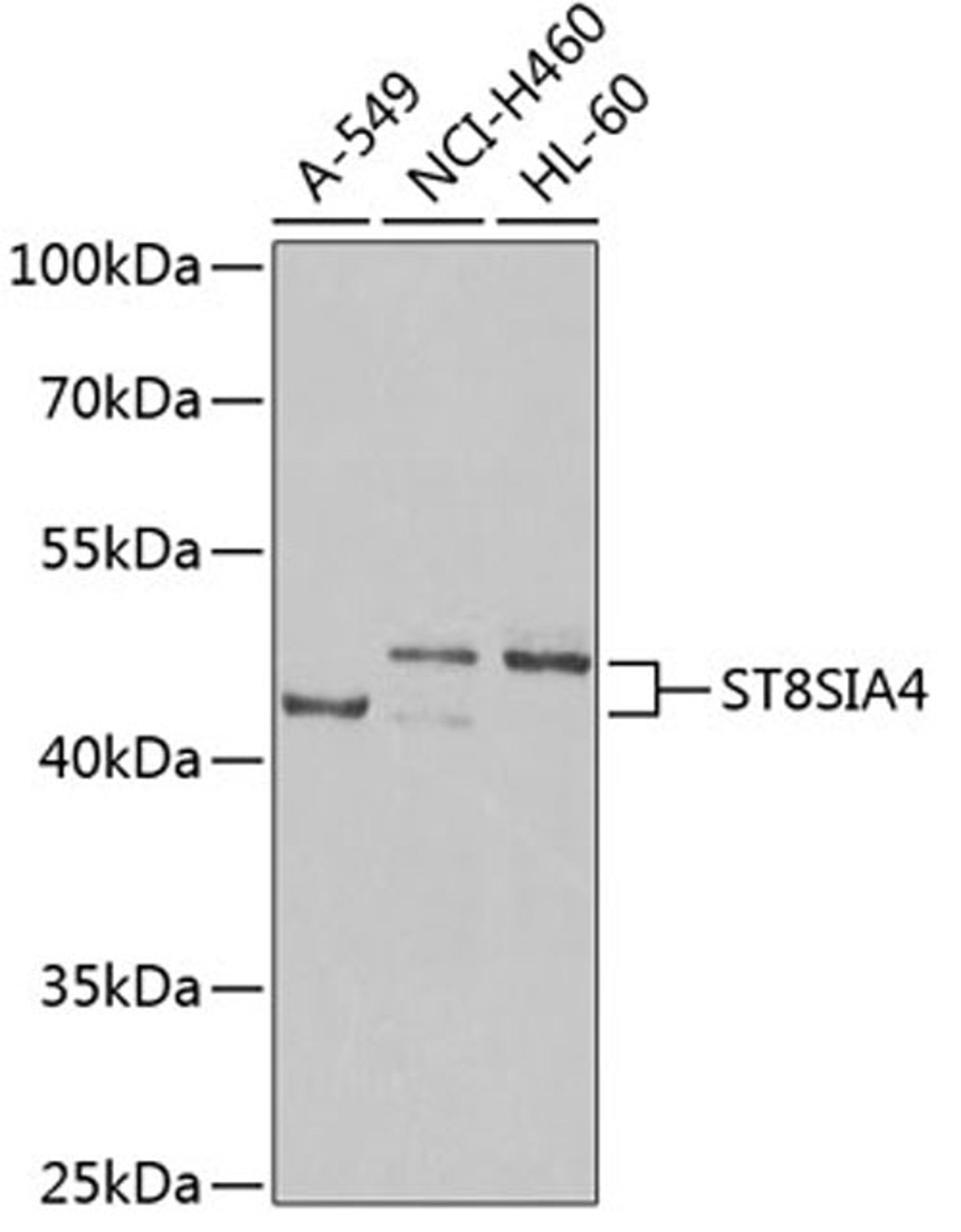 Western blot - ST8SIA4 Antibody (A6754)