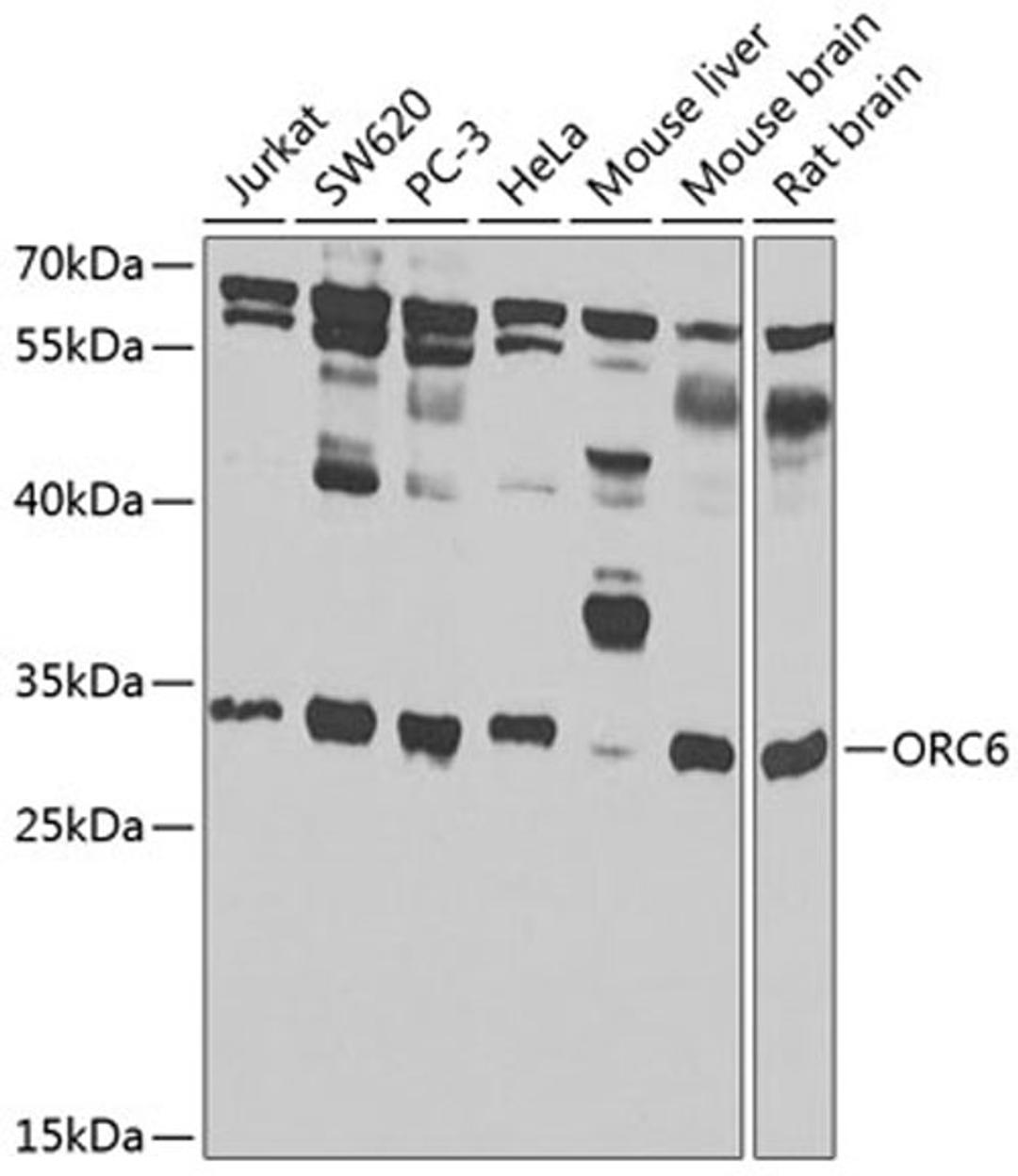 Western blot - ORC6 antibody (A7966)