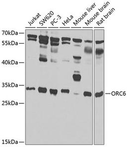 Western blot - ORC6 antibody (A7966)