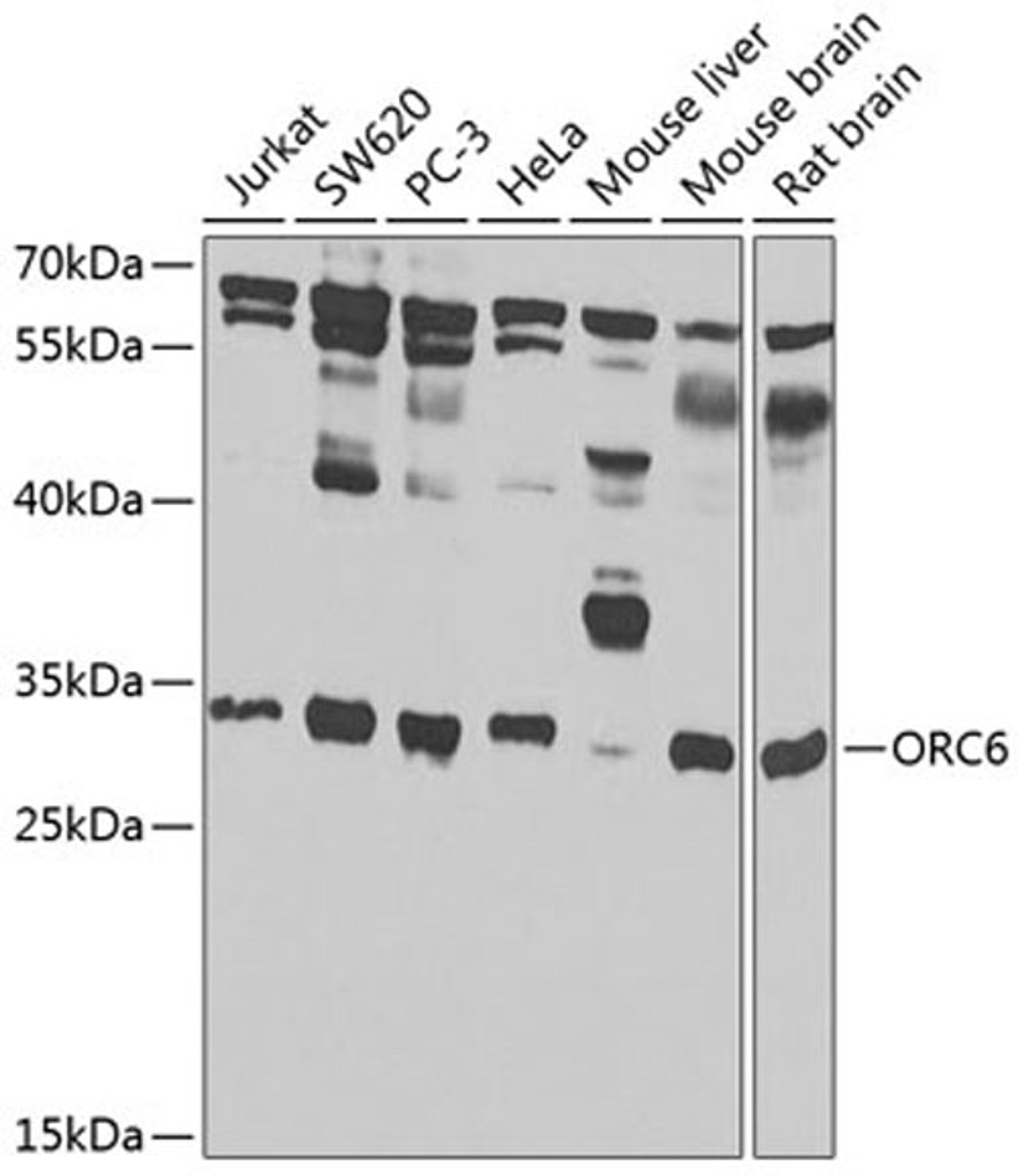 Western blot - ORC6 antibody (A7966)