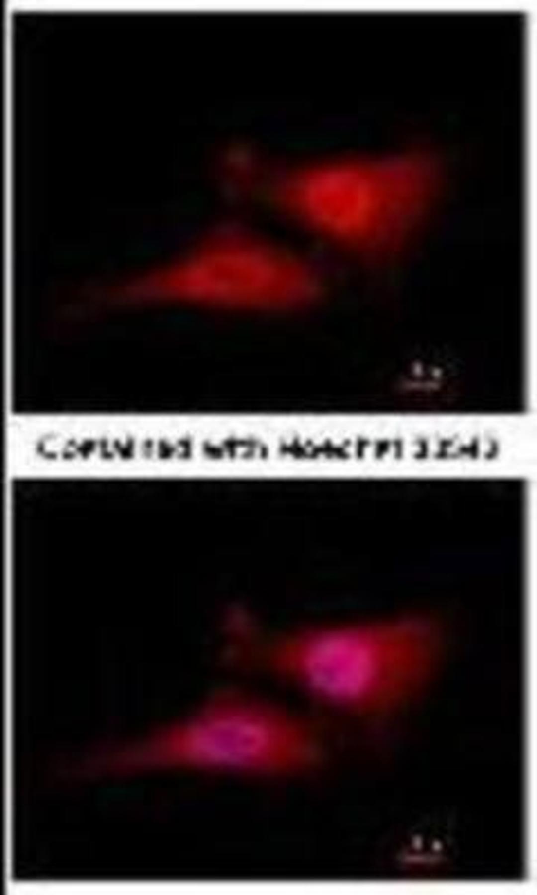 Immunocytochemistry/Immunofluorescence: Cdc34 Antibody (14B5) [NB500-168] - Analysis of paraformaldehyde-fixed HeLa, using CDC34 antibody at 1:100 dilution.