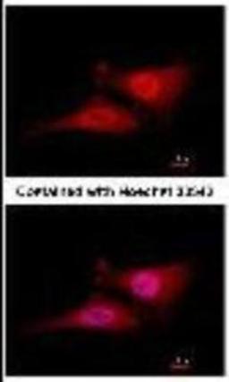 Immunocytochemistry/Immunofluorescence: Cdc34 Antibody (14B5) [NB500-168] - Analysis of paraformaldehyde-fixed HeLa, using CDC34 antibody at 1:100 dilution.