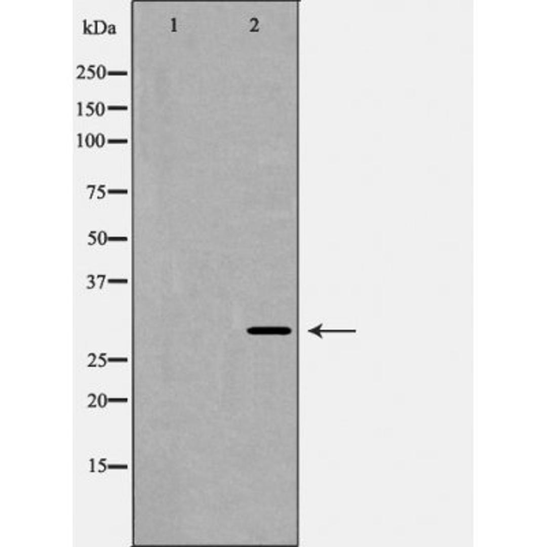 Western blot analysis of A431 cells using Calsenilin antibody