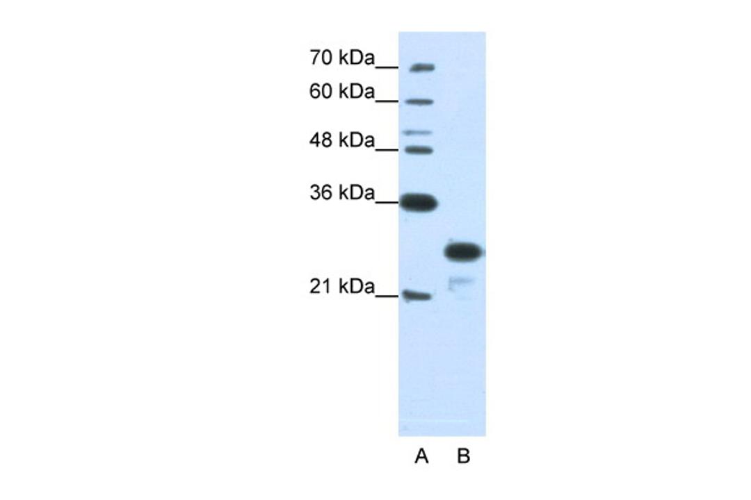 Antibody used in WB on Human Jurkat 1.25 ug/ml.