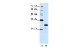 Antibody used in WB on Human Jurkat 1.25 ug/ml.