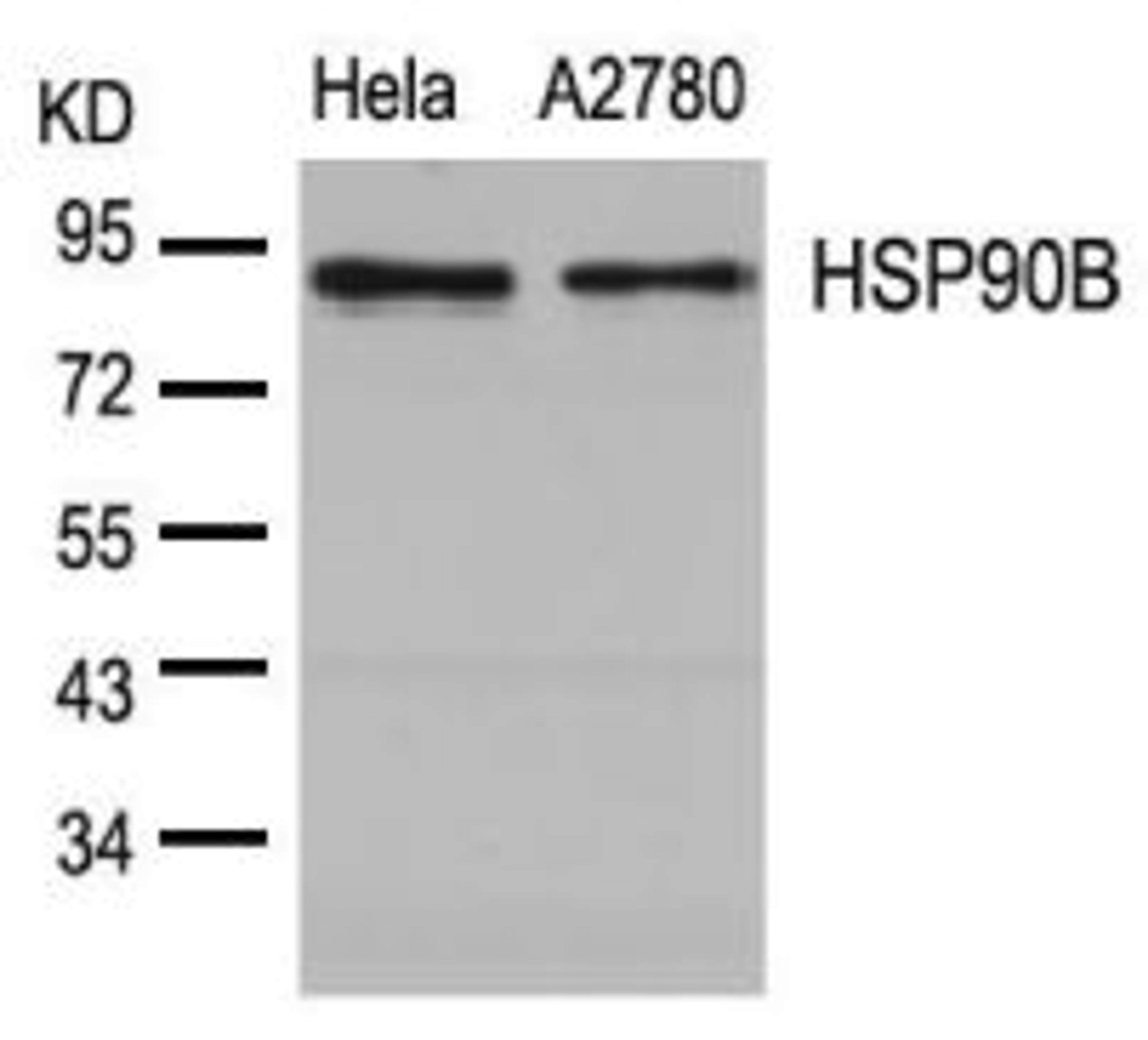 Western blot analysis of lysed extracts from HeLa and A2780 cells using HSP90B (Ab-254).