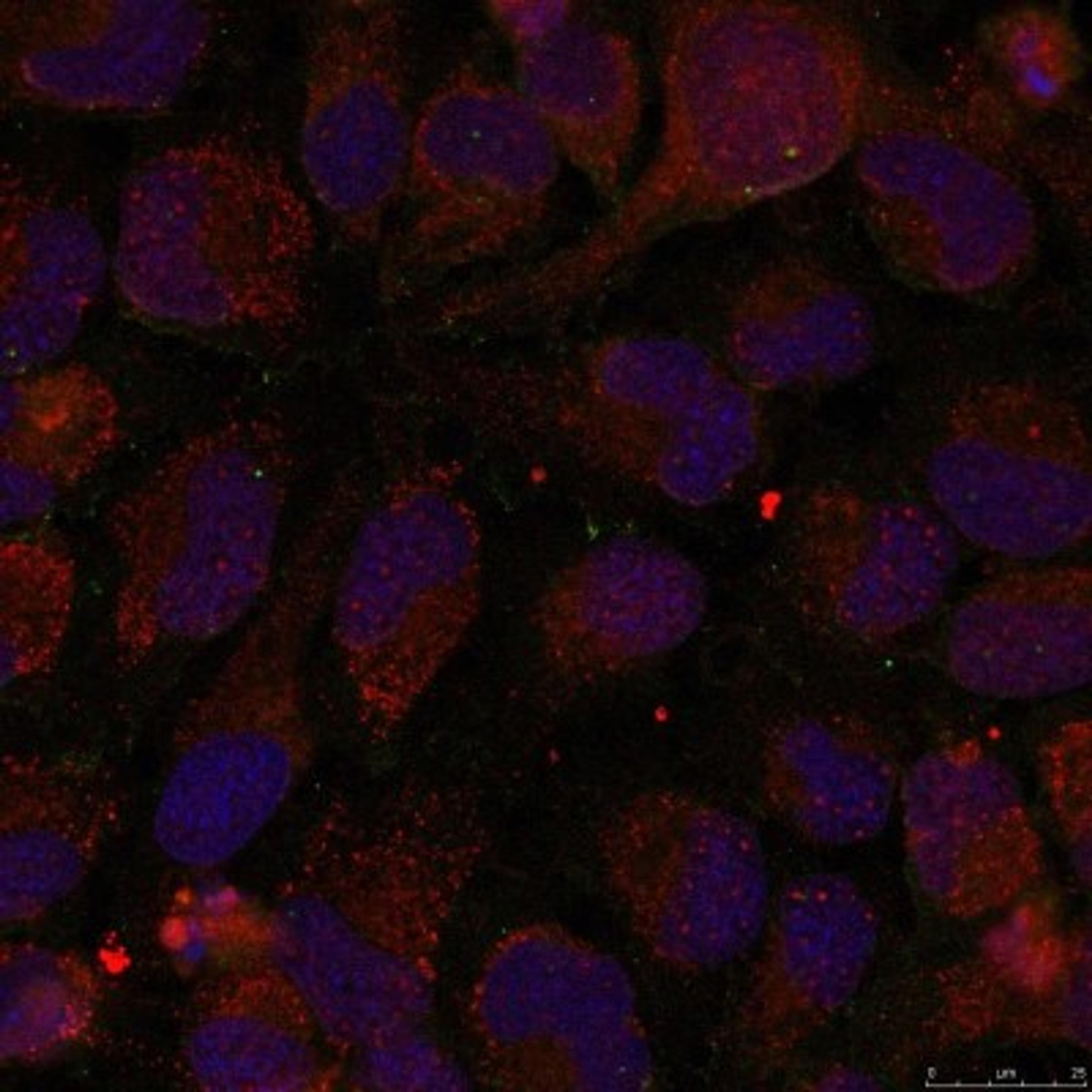 Immunocytochemistry/Immunofluorescence: GATA1 [p Ser142] Antibody [NB100-81937] - Staining of methanol-fixed Hela cells using GATA1(Phospho-Ser142) antibody