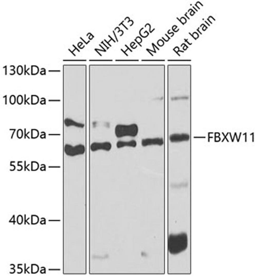 Western blot - FBXW11 antibody (A7784)