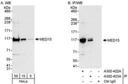 Detection of human MED15 by western blot and immunoprecipitation.