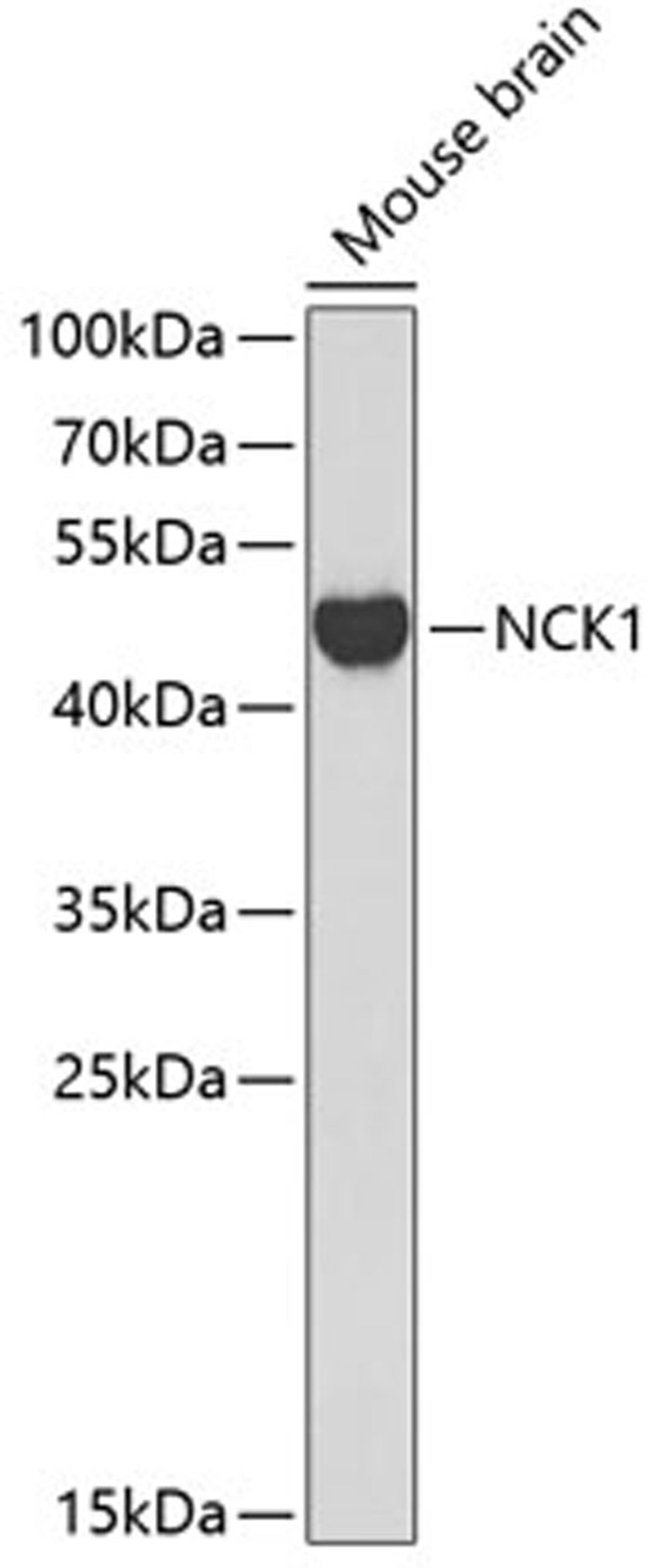 Western blot - NCK1 antibody (A0999)