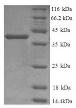 (Tris-Glycine gel) Discontinuous SDS-PAGE (reduced) with 5% enrichment gel and 15% separation gel.