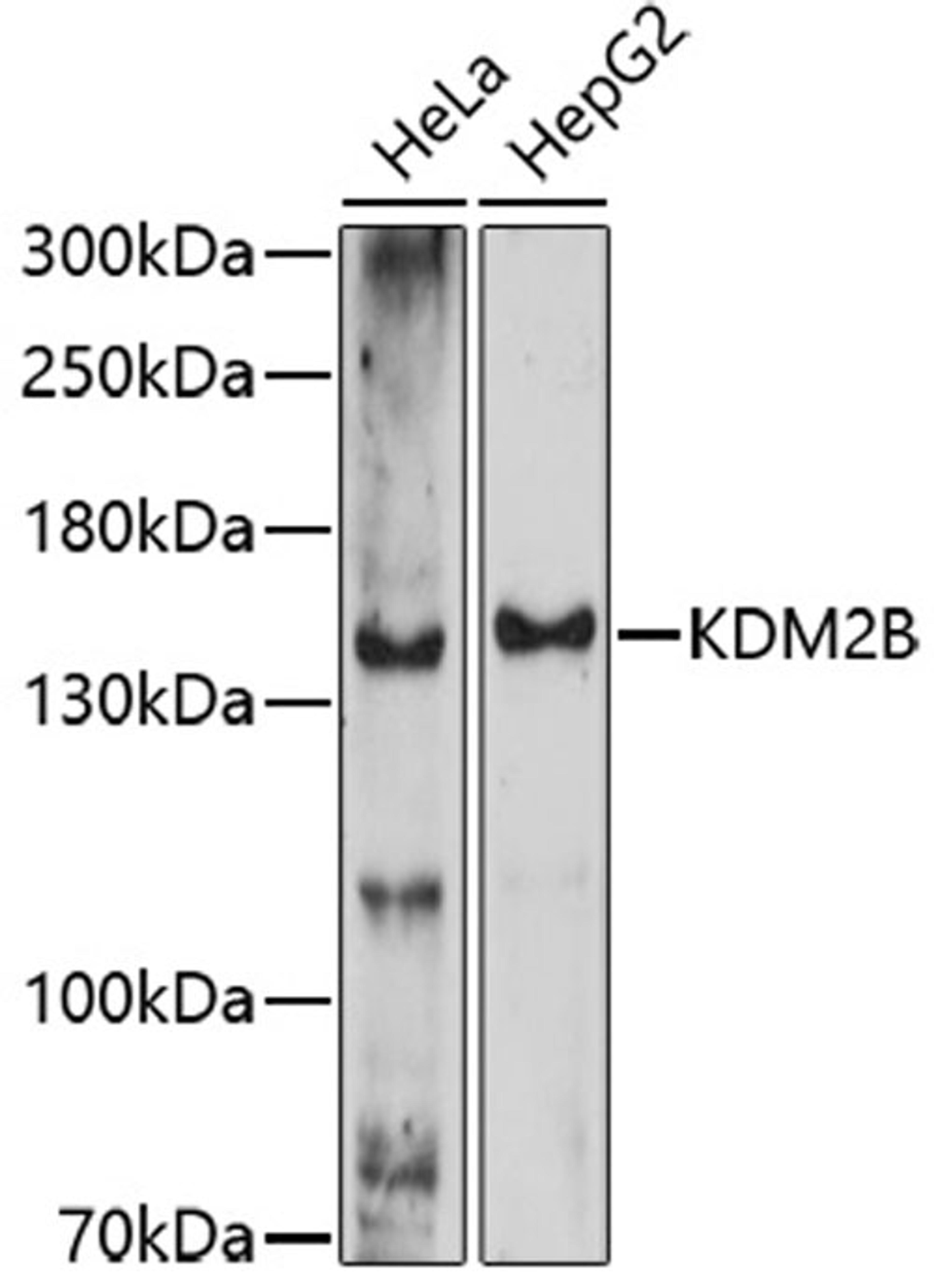 Western blot - KDM2B antibody (A16017)