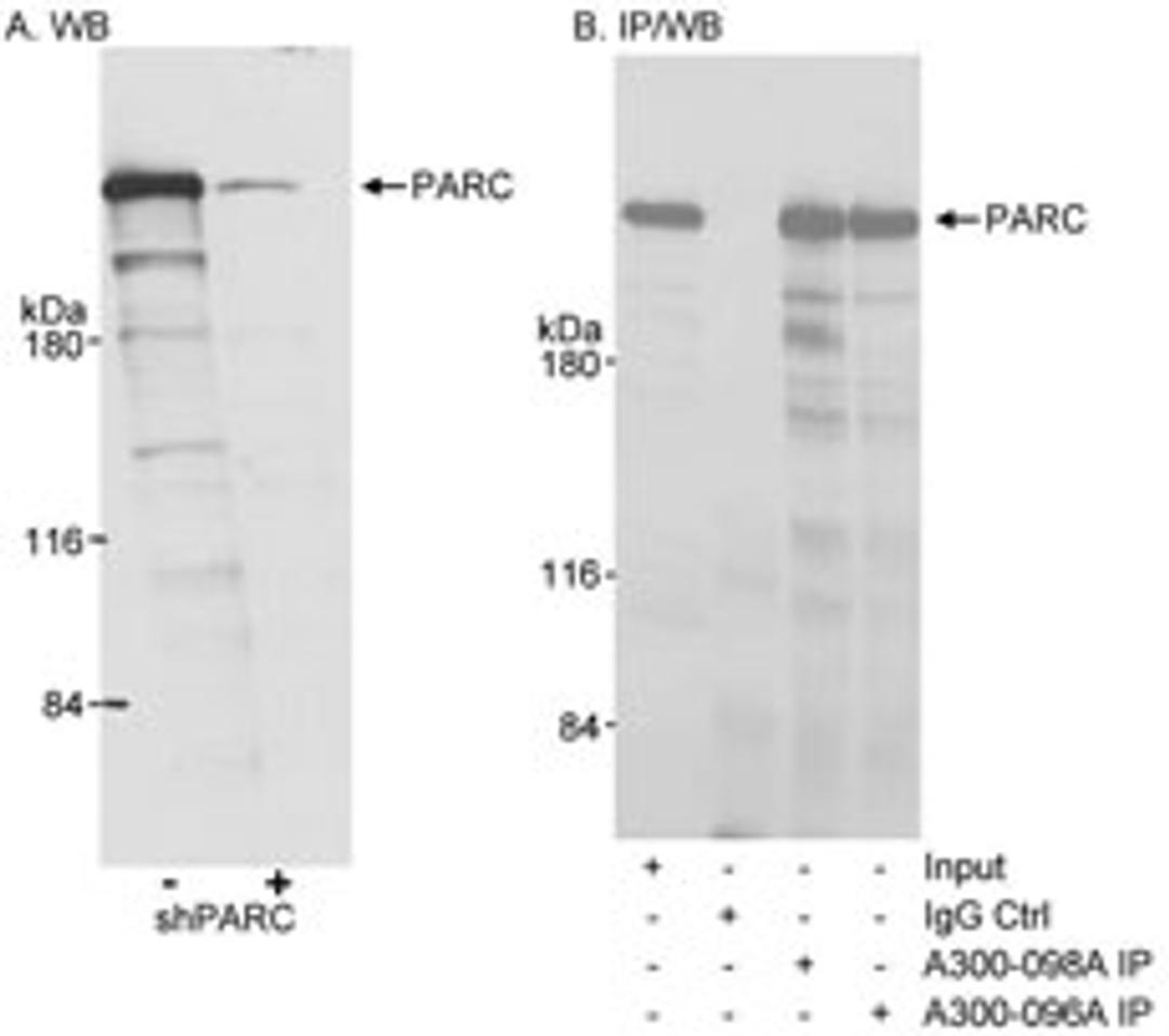 Detection of human PARC by western blot and immunoprecipitation.