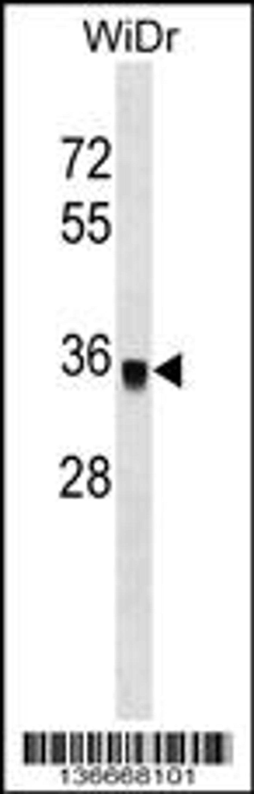 Western blot analysis in WiDr cell line lysates (35ug/lane).