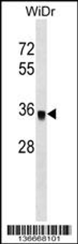 Western blot analysis in WiDr cell line lysates (35ug/lane).