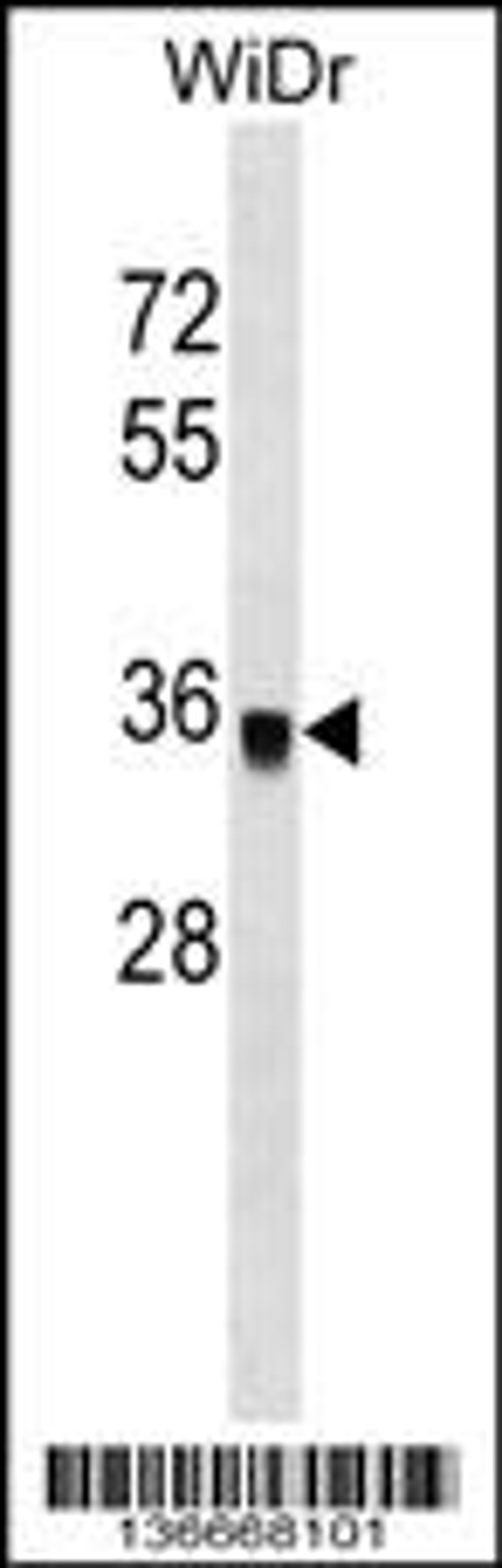 Western blot analysis in WiDr cell line lysates (35ug/lane).