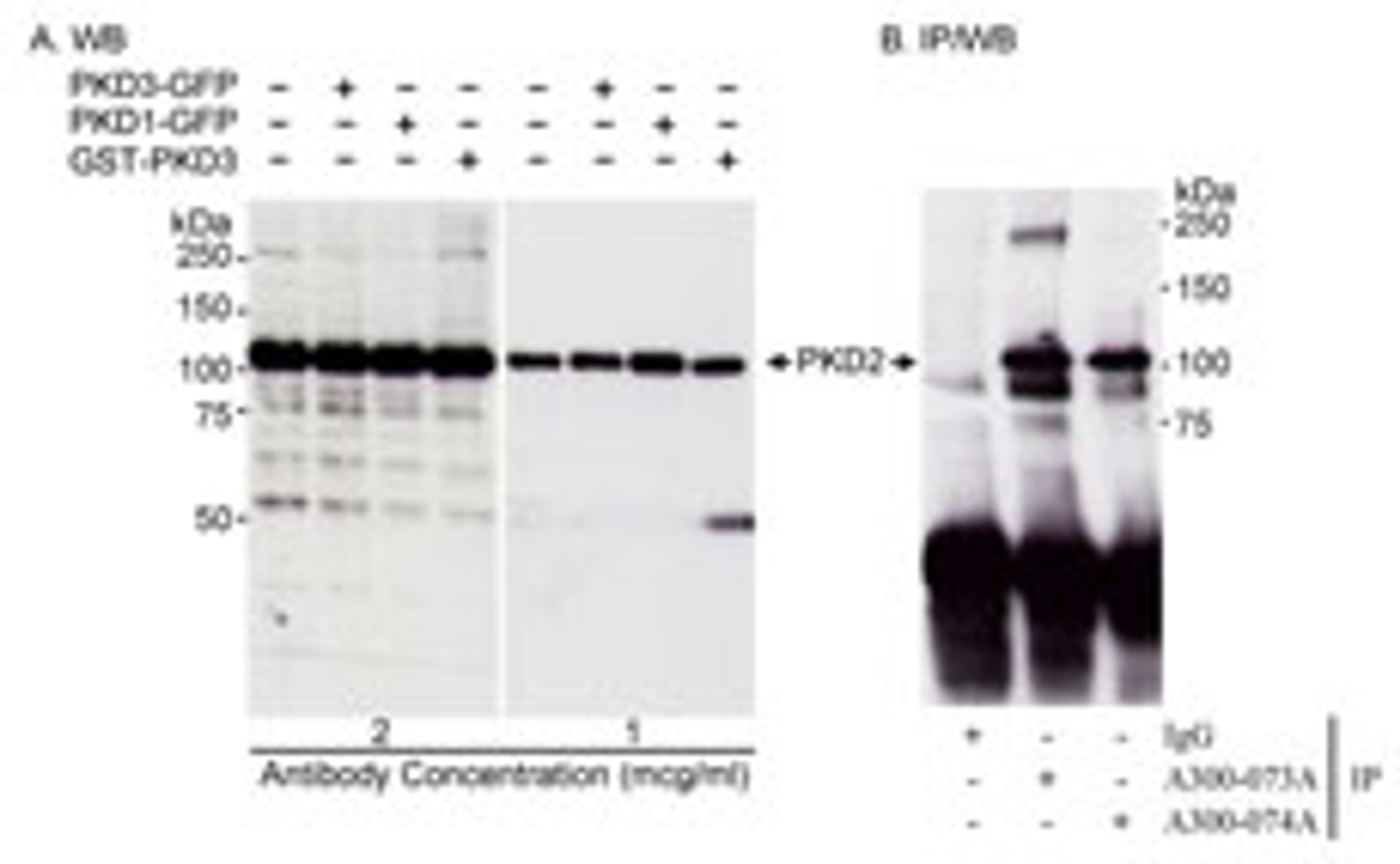 Detection of human PKD2 by western blot and immunoprecipitation.