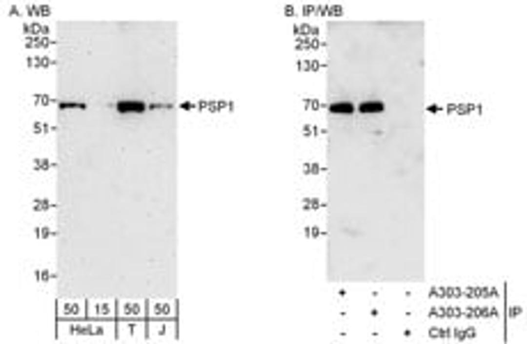 Detection of human PSP1 by western blot and immunoprecipitation.