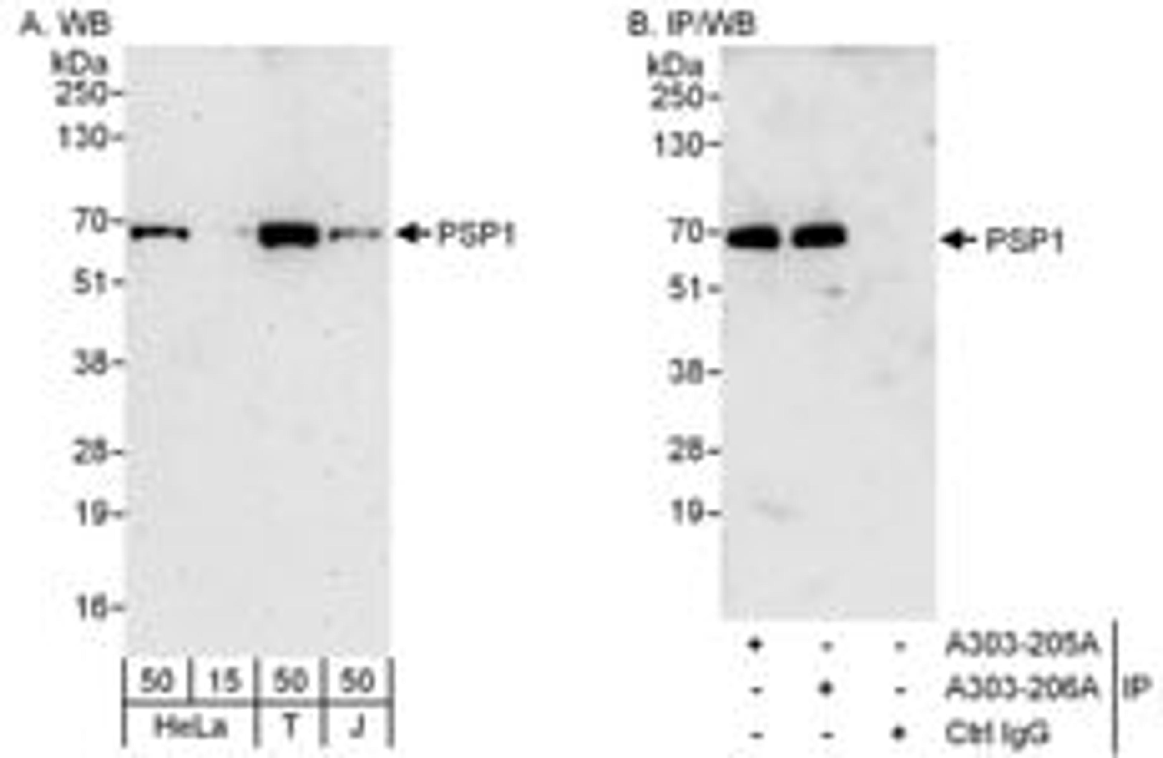 Detection of human PSP1 by western blot and immunoprecipitation.