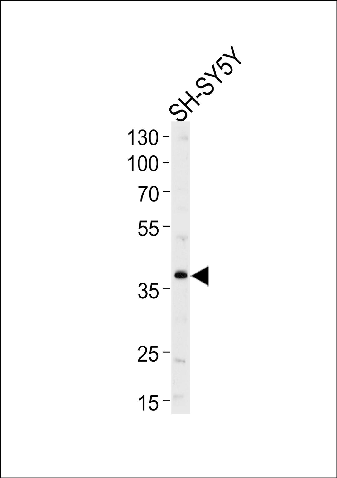 Western blot analysis of lysate from SH-SY5Y cell line, using SERPINI1 Antibody at 1:1000 at each lane.