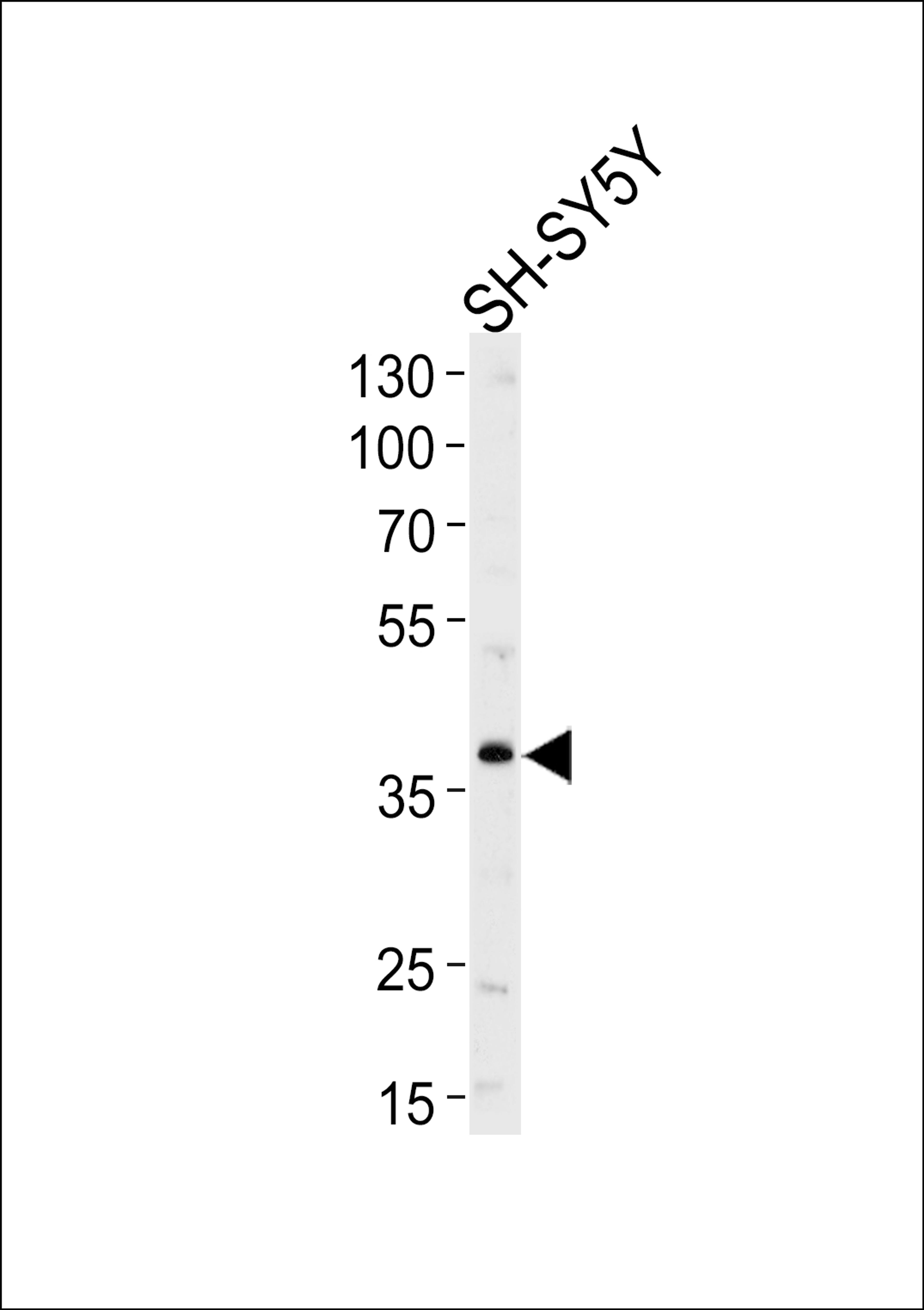 Western blot analysis of lysate from SH-SY5Y cell line, using SERPINI1 Antibody at 1:1000 at each lane.