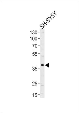 Western blot analysis of lysate from SH-SY5Y cell line, using SERPINI1 Antibody at 1:1000 at each lane.