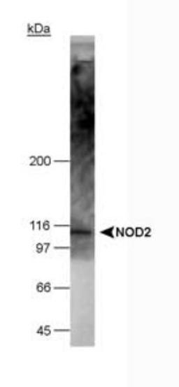 Western Blot: NOD2 Antibody (2D9) [NB100-524] - Detection of NOD2 in 20ug of NOD2 transfected 293T cell lysate using NB 100-524. ECL detection in 10 seconds.