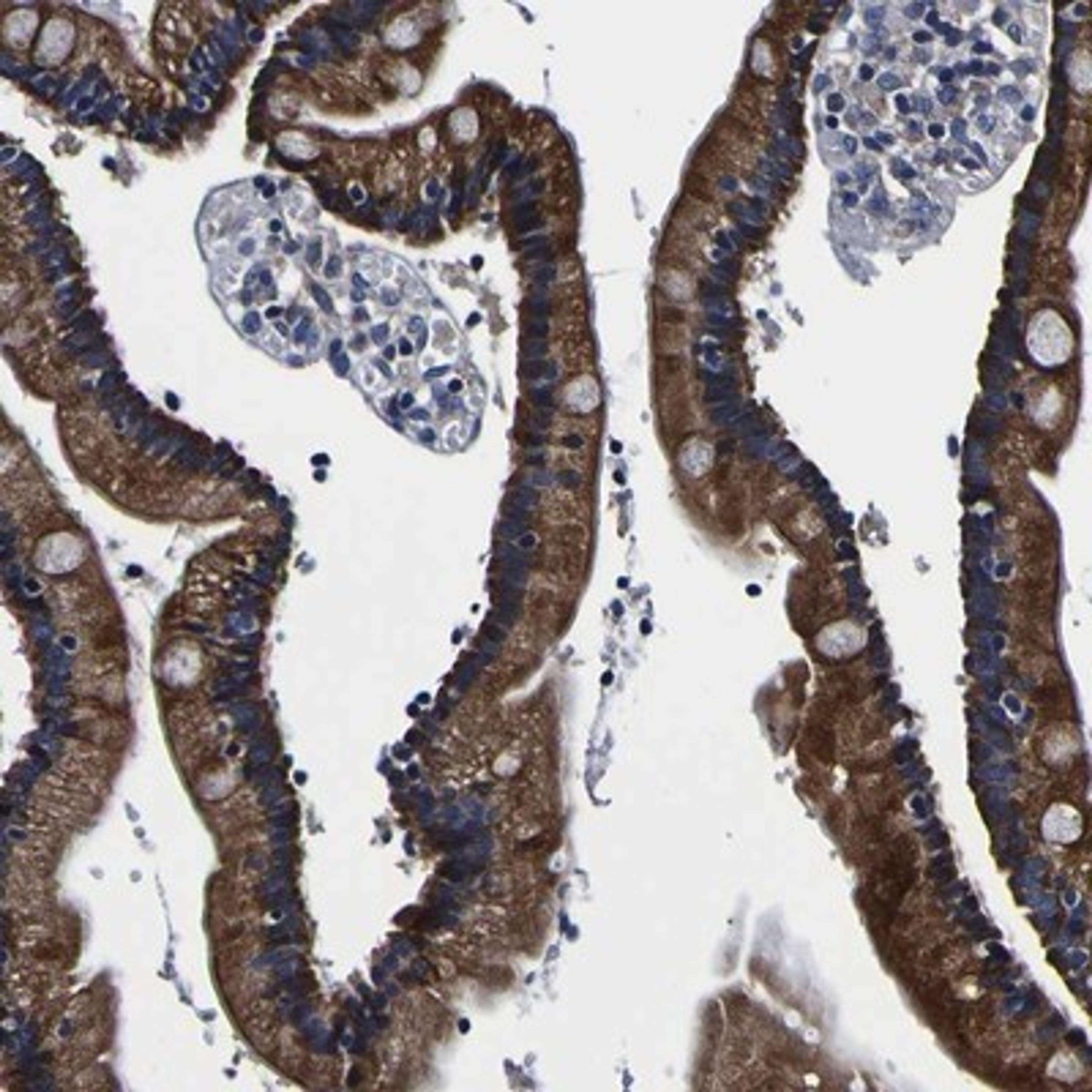 Immunohistochemistry-Paraffin: PDLIM4 Antibody [NBP1-80833] - Staining of human duodenum shows strong cytoplasmic positivity in glandular cells.