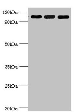 Western blot. All lanes: 116 kDa. U5 small nuclear ribonucleoprotein component antibody at 3ug/ml. Lane 1: Hela whole cell lysate. Lane 2: 293T whole cell lysate. Lane 3: NIH/3T3 whole cell lysate. Secondary. Goat polyclonal to rabbit IgG at 1/10000 dilution. Predicted band size: 47, 44, 37 kDa. Observed band size: 109 kDa. 