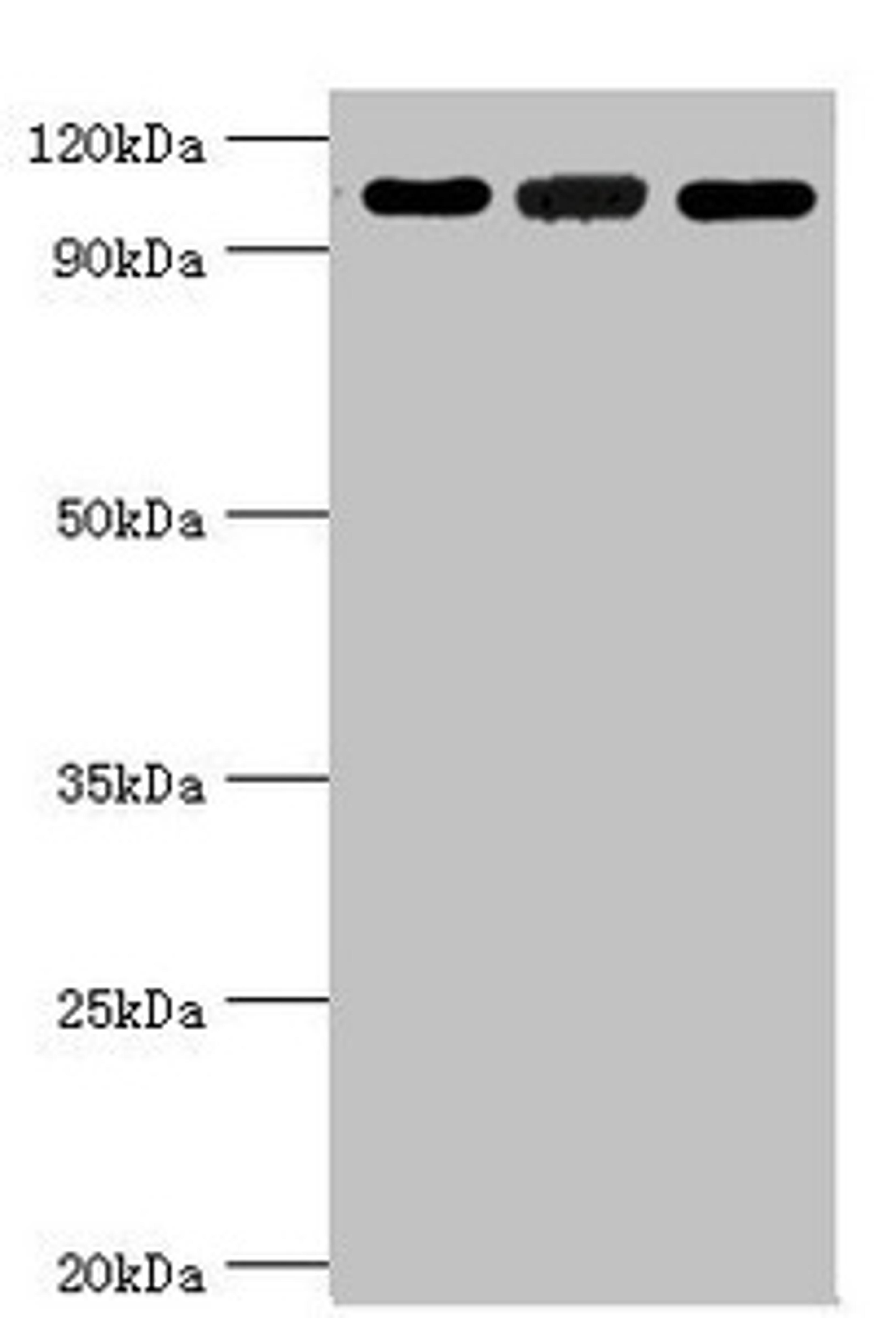 Western blot. All lanes: 116 kDa. U5 small nuclear ribonucleoprotein component antibody at 3ug/ml. Lane 1: Hela whole cell lysate. Lane 2: 293T whole cell lysate. Lane 3: NIH/3T3 whole cell lysate. Secondary. Goat polyclonal to rabbit IgG at 1/10000 dilution. Predicted band size: 47, 44, 37 kDa. Observed band size: 109 kDa. 