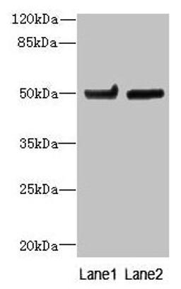Western blot. All lanes: TUBB6 antibody at 4ug/ml. Lane 1: Hela whole cell lysate. Lane 2: MDA-MB-231 whole cell lysate. Secondary. Goat polyclonal to rabbit IgG at 1/10000 dilution. Predicted band size: 50 kDa. Observed band size: 50 kDa. 