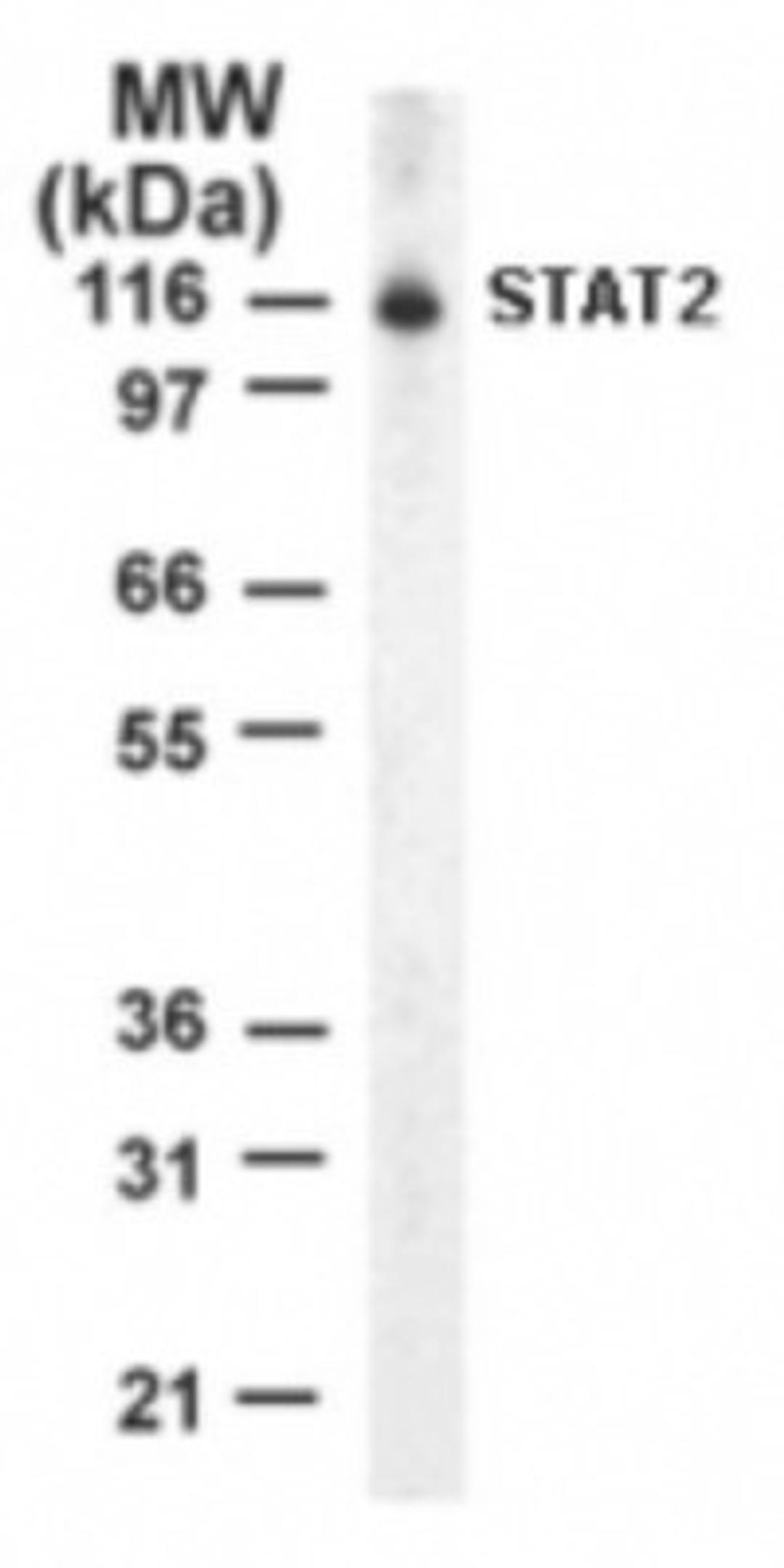 Western Blot: STAT2 Antibody [NB100-56323] - Analysis of STAT2 in Jurkat cell lysate using this antibody at 3 ug/ml.