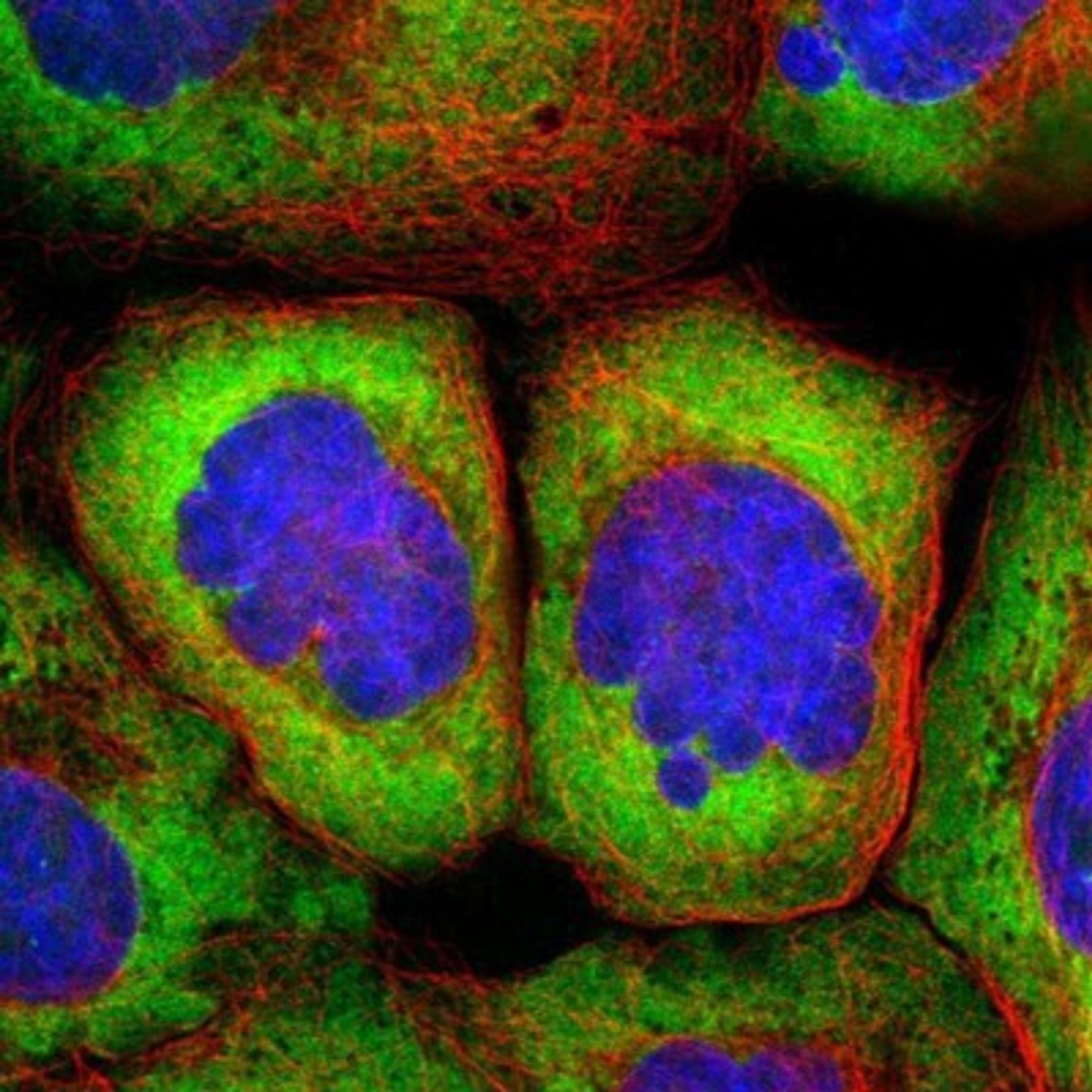 Immunocytochemistry/Immunofluorescence: RPS25 Antibody [NBP1-80802] - Staining of human cell line A-431 shows positivity in cytoplasm.