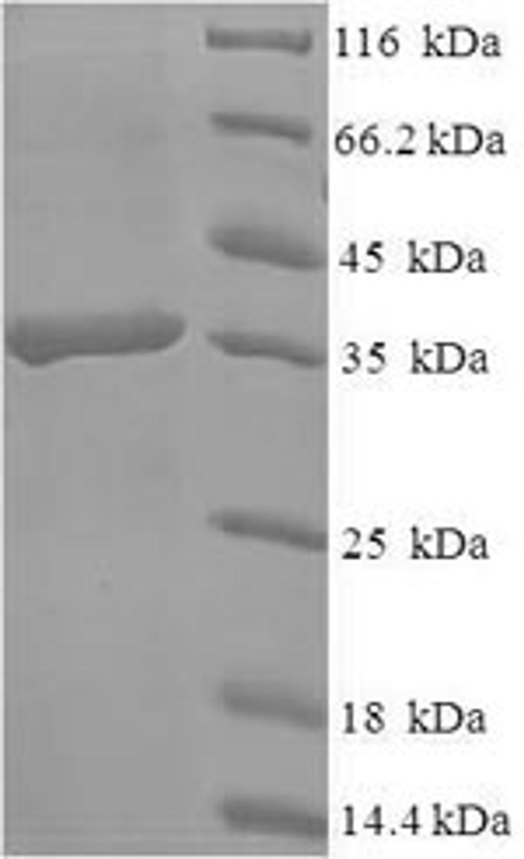 (Tris-Glycine gel) Discontinuous SDS-PAGE (reduced) with 5% enrichment gel and 15% separation gel.