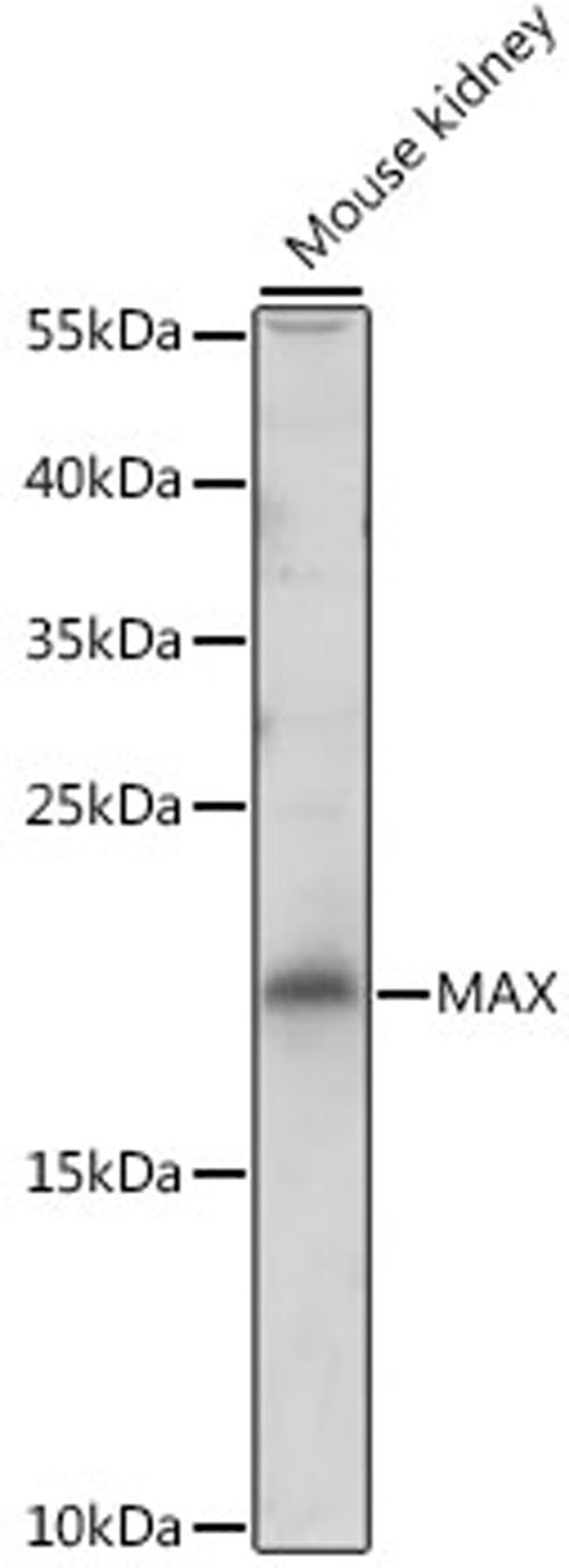 Western blot - MAX antibody (A2157)