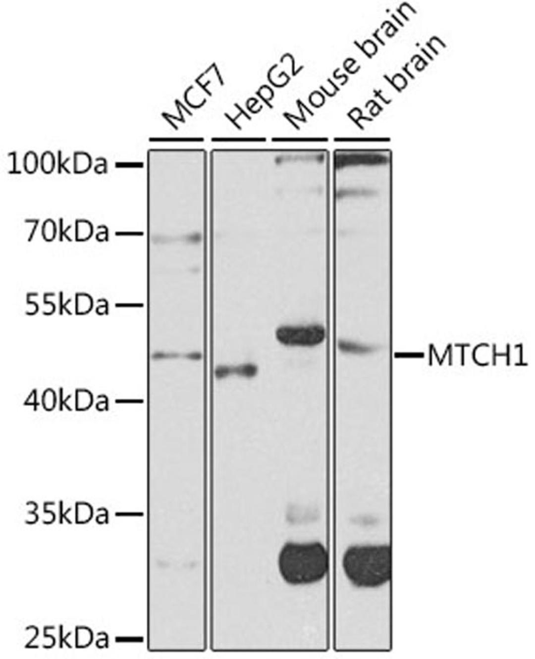 Western blot - MTCH1 antibody (A8063)