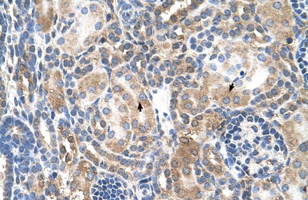 Antibody used in IHC on Human kidney.